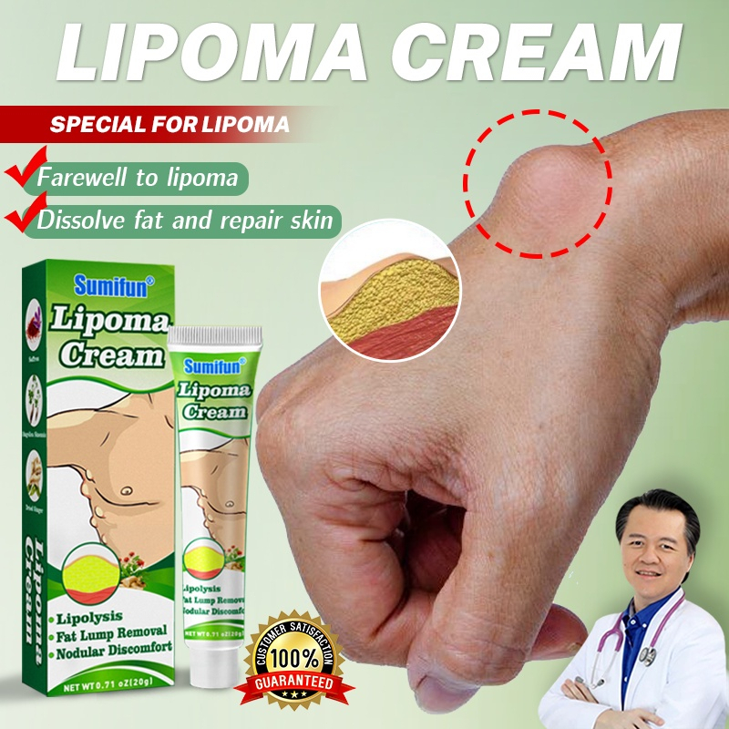 Sumifun Obat Benjolan Lipoma Salep Lipoma Cream Herbal/Fibroid/Benjolan Subkutan/Leher Benjolan/Punggung Pundak Benjolan/Kista Ganglion Benjolan/Kelenjar Tiroid Limfoma Limpoma Kelenjar-20g Lipoma Remover Treatment Ointment