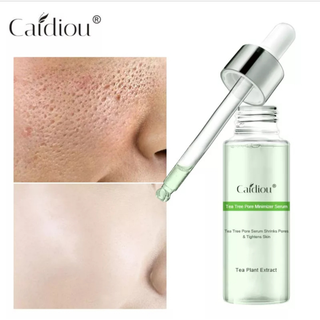 CAIDIOU TEA TREE SERUM PENGECIL PORI-PORI PENGONTROL MINYAK BERLEBIH ANTI PENUAAN/TEA TREE SERUM SHR