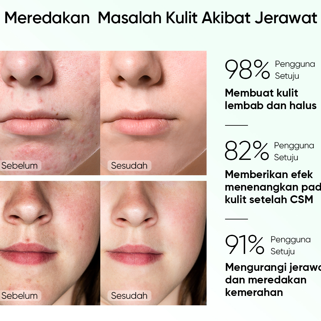 (New IN) SKINTIFIC Pure Centella Acne Calming Toner Essence 80ml Oil Control Purifying Toner Skin Barrier Smoothing Redness