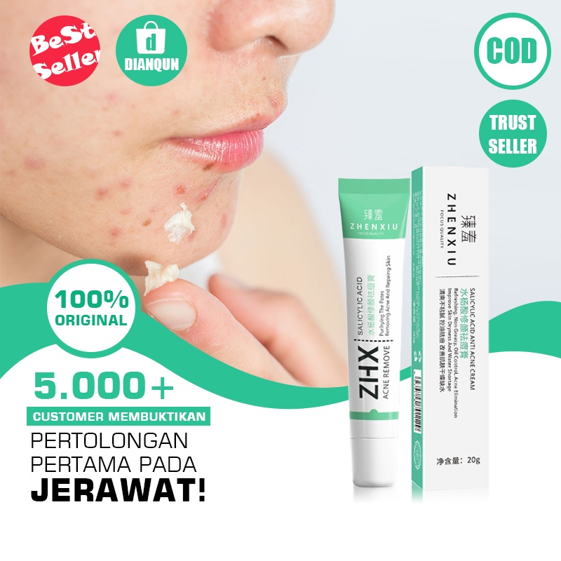 Zhenxiu Krim Anti Jerawat Krim Jerawat Salep Jerawat Cream Jerawat 20g Gel Anti Jerawat Herbal Essence Menghilangkan Jerawat Memperbaiki Kulit Dengan Cepat Menghilangkan Jerawat Pria Dan Wanita