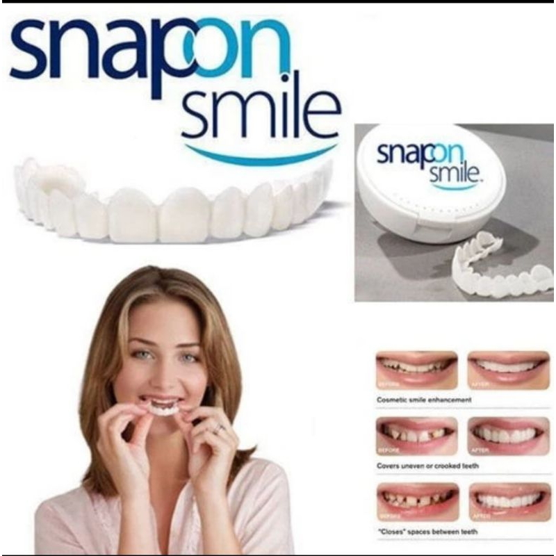 Snap On Smile 100% ORIGINAL 1 SET Atas Bawah Authentic Perawatan Kesehatan Gigi Palsu Renggang Snapo