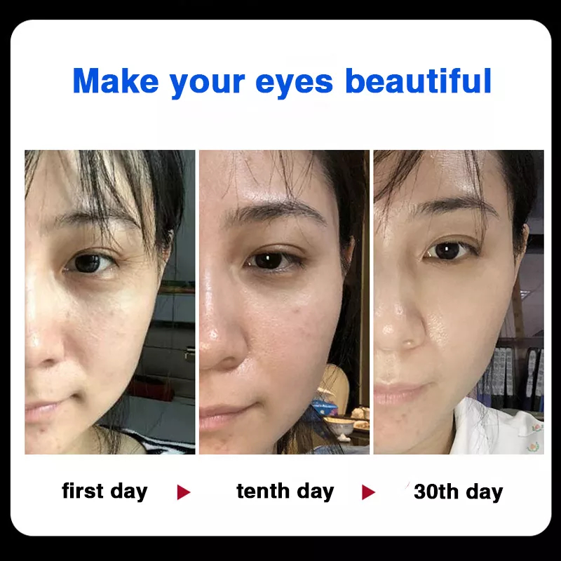 Eye Treatment Cream Krim Mata Atasi Kerutan,activating close repair eye cream 20g Elastic Moisturizing Anti-Wrinkle Against Eye Circles Dark and Puffiness Eye Firming Cream