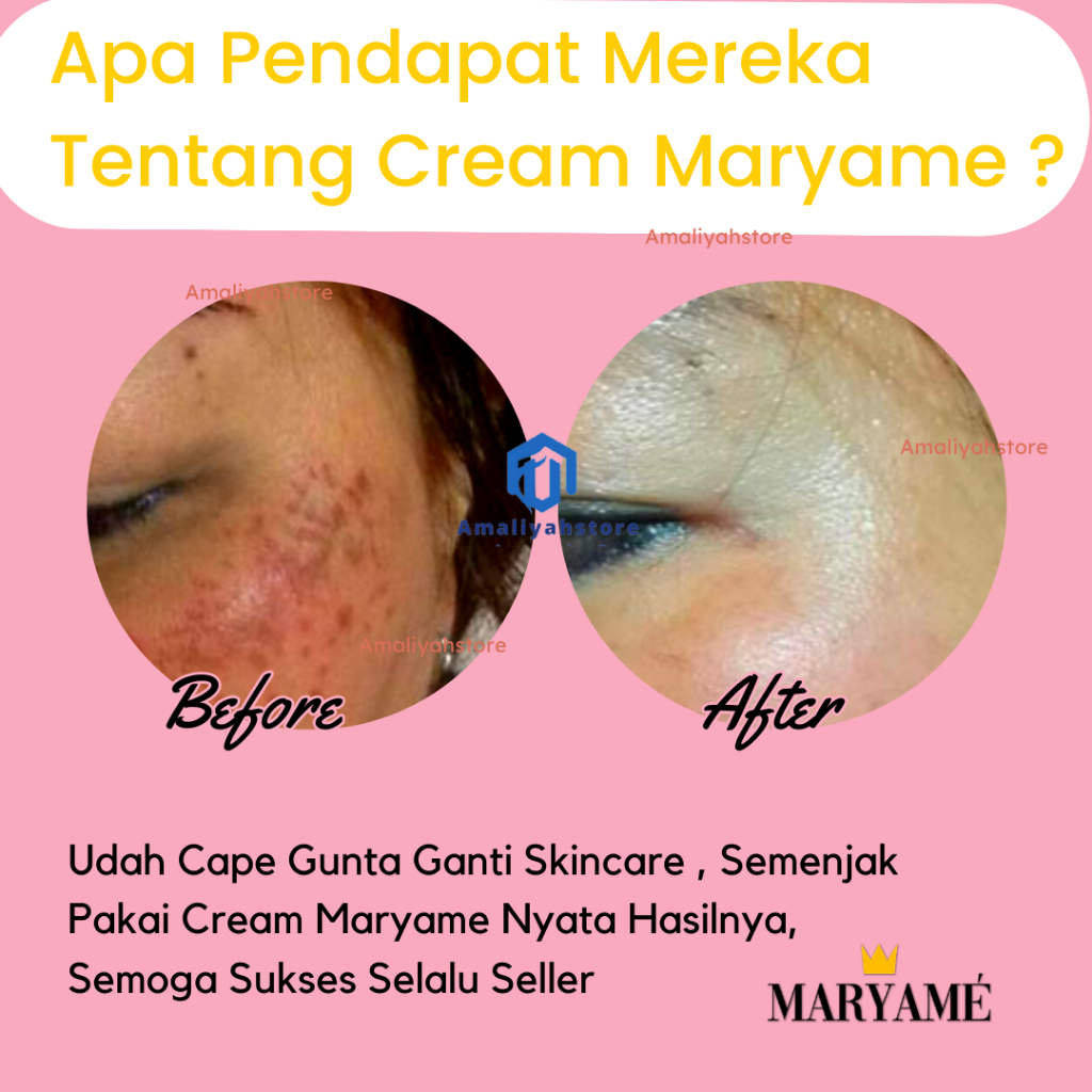 Maryame Beauty Glow Up Cream Skincare Pemutih Wajah Dan Penghilang Bekas Jerawat Anti Flek Hitam Cepat Glowing Permanen 100% Ori