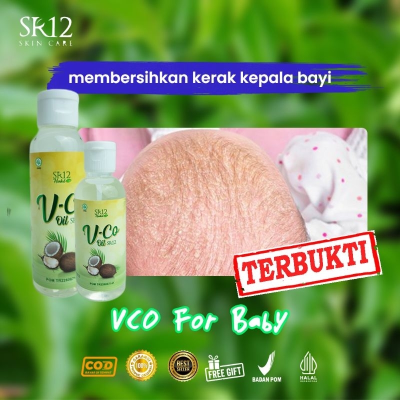 (GRATIS HADIAH) VCO SR12 Untuk Ruam Popok Bayi Biang Keringat Minyak Kelapa Untuk Bayi VCO sebagai m