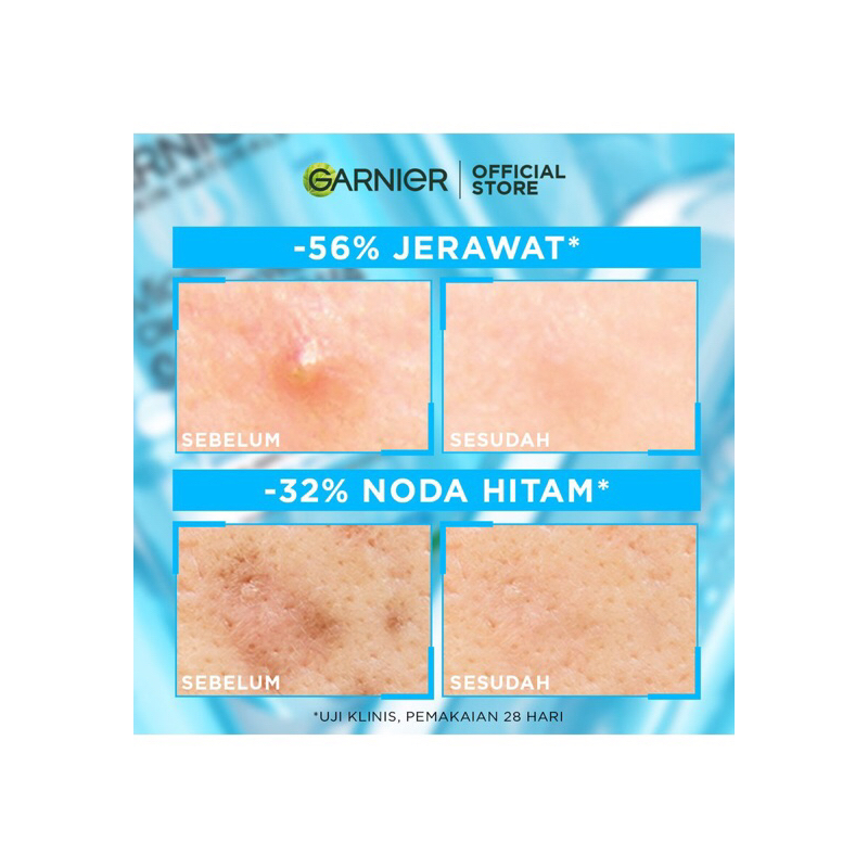 Garnier Micellar Blue dengan New Formula Salicylic BHA