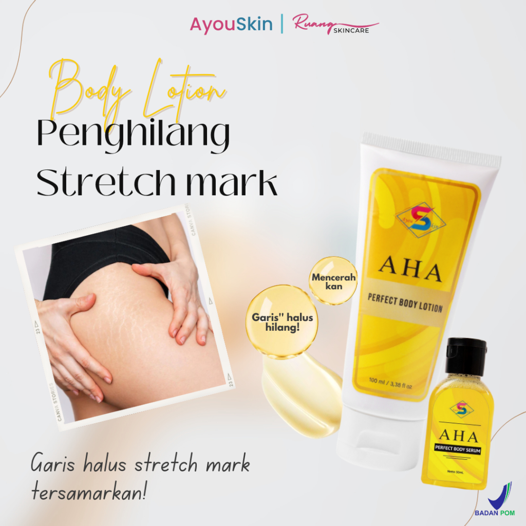 Krim Penghilang Stretch Mark Ampuh, Lotion Penghilang Strechmark, Cream Penghilang Selulit, Menyamar