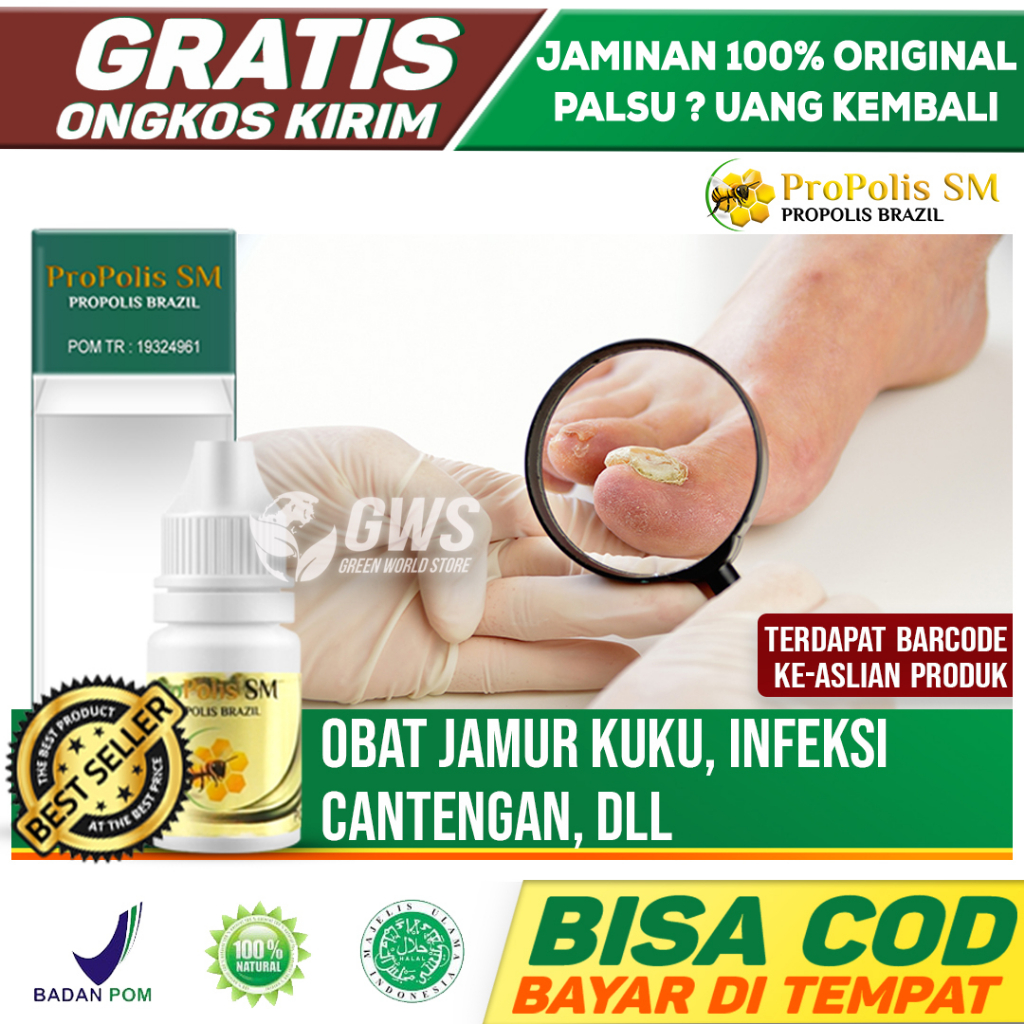 Propolis Obat Jamur Kuku Paling Ampuh, Obat Kuku Rusak Busuk Berjamur Infeksi kuku Jempol Herbal