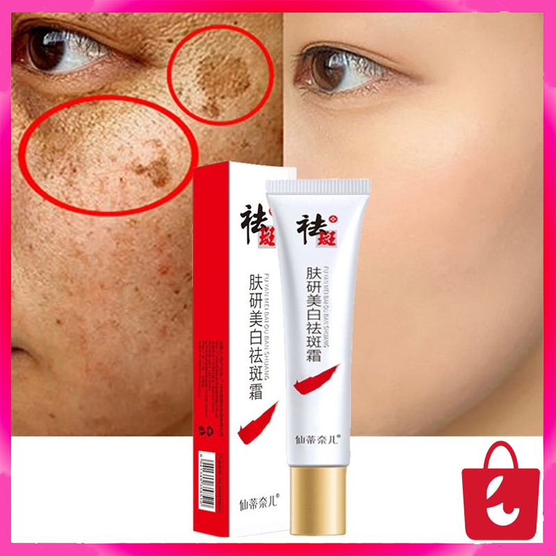 CINDYNAL Whitening Freckle Cream Remove Penghilang Noda Kulit Krim Wajah Pemutih Krim Pemutih Penghilang Bintik Jerawat Melasma Melanin Salep Pigmen