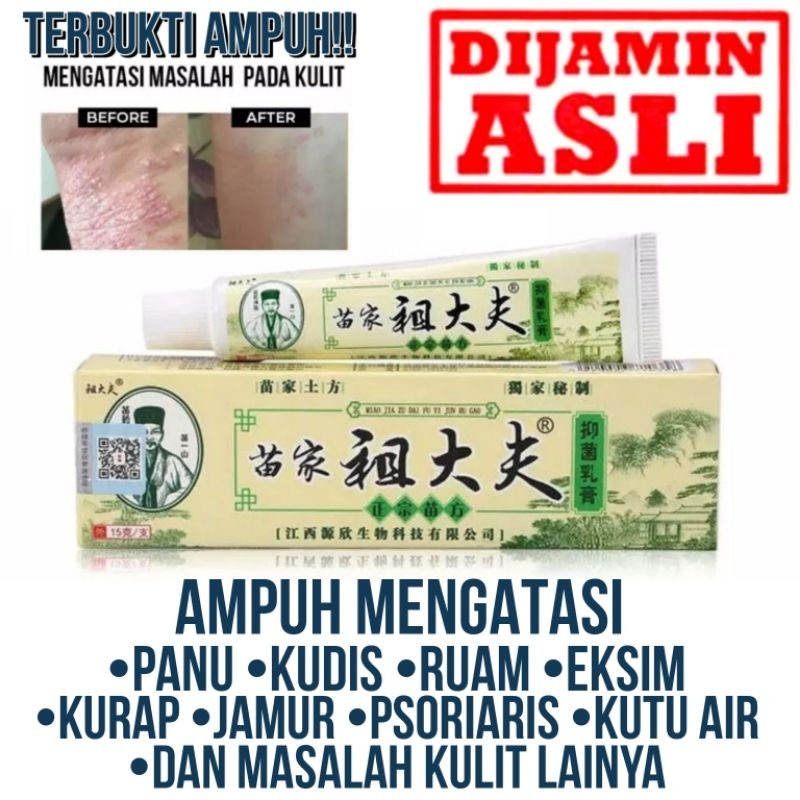 [100% Asli] Chy Gao Zudaifu Salep Obat Gatal Selangkangan Eksim Kulit Gatal Jerawat Kudis Jamur Sale