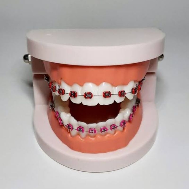 Lem Behel Gigi - Lem Gigi Palsu