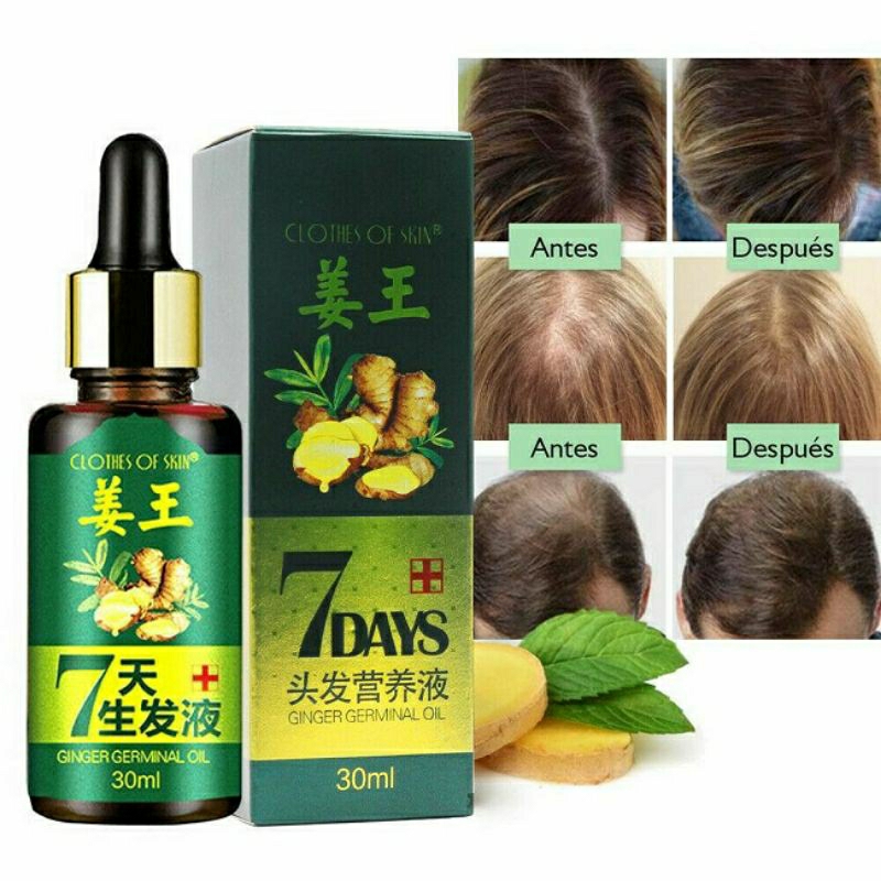 [30ml] SERUM ESSENCE CLOTHES OF SKIN 7 DAYS ORIGINAL GINGER OIL PENUMBUH RAMBUT BOTAK AMPUH ANTI RONTOK