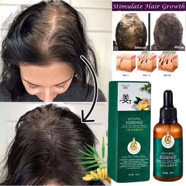 Minyak Rambut Kemiri Balitung Penyubur dan Penghilang Uban Ulin Alami Permanen