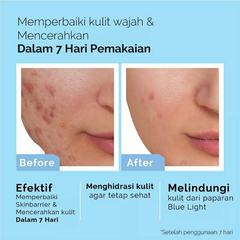 ANIMATE Glowing Barrier Skin Repair Series - Pelembab Wajah