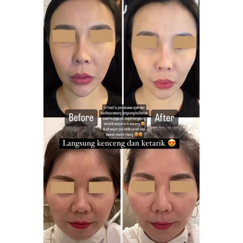 BB Glow Mask Lifting Teen Ex