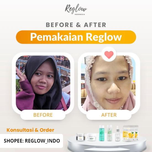 PROMO PAYDAY Reglow Night Cream + Toner Skincare Dokter Shindy Best Combo