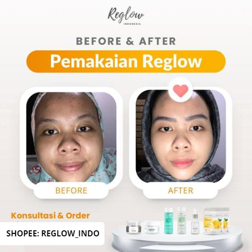 [Twin Pack] Reglow Glowing Whitening Serum dr Shindy Skincare Original