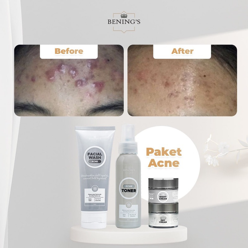 BENING SKINCARE ACNE | DR. OKY PRATAMA BENING CLINIC