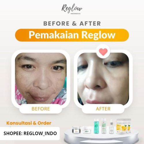 REGLOW 3PCS PAKET FLEK Serum Day + Night Cream dr Shindy Skincare Original