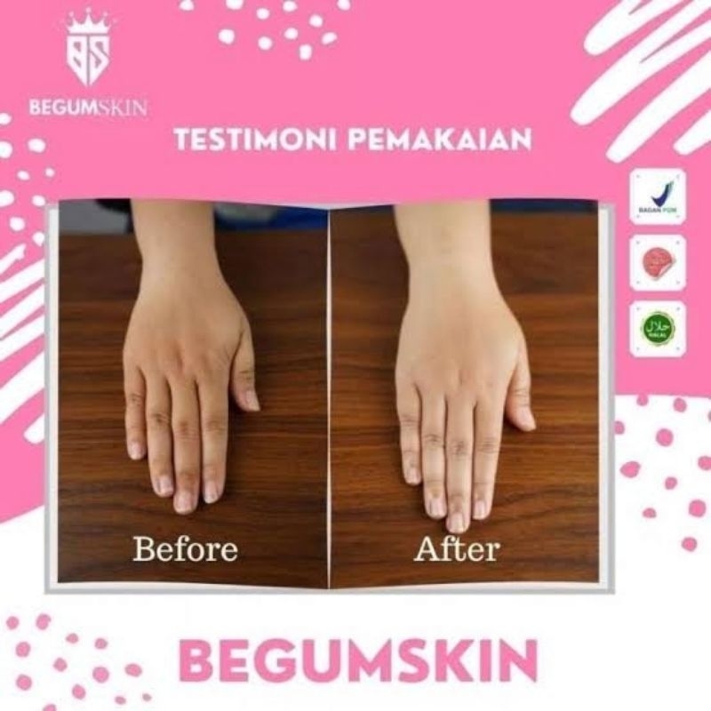 Begumskin Skincare Hand Body Lotion | Begum Skin Whitening BPOM Resmi 250ml