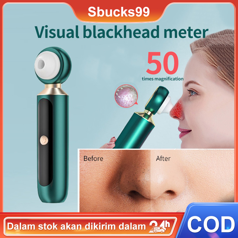 Alat pembersih Komedo Facial Wajah Penyedot Komedo Dengan Kaca Sedot Komedo /vakum Komedo/tools pembersih komedo