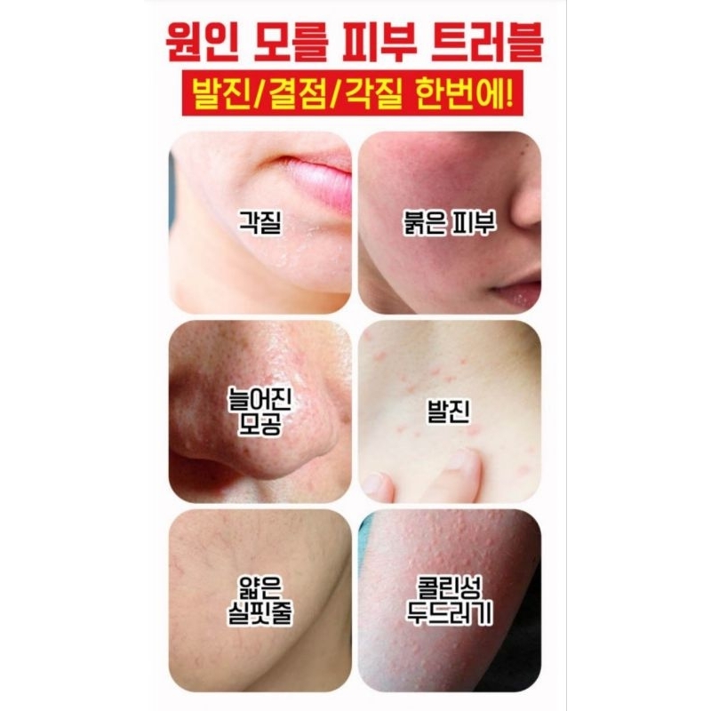 🇰🇷ATLEE FIRST AID CARE CREAM AHA BHA PHA LHA 30ML