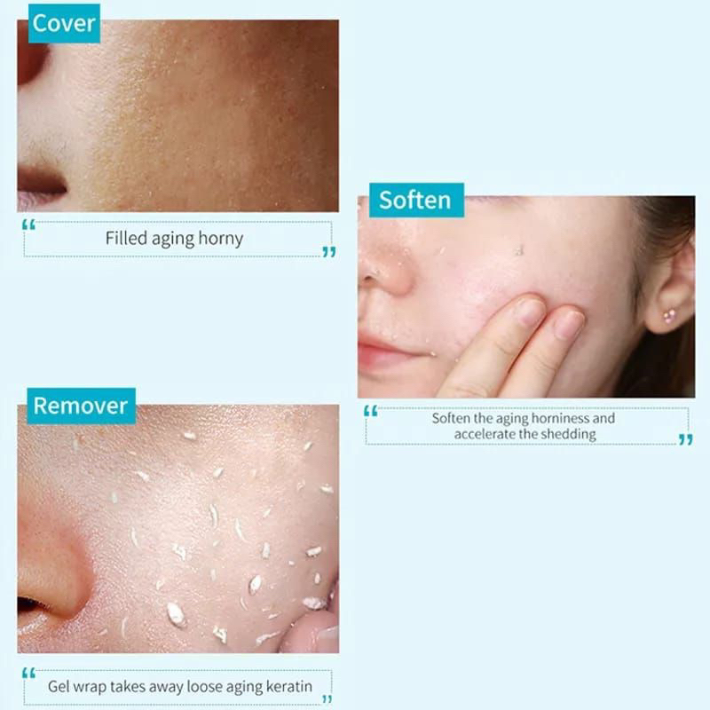 {Gratis Ongkir} COD Medan termurah Qianzi Gentel Centtella Exfoliating Gel Mencerahkan dan Mengangkat Sel Kulit Mati