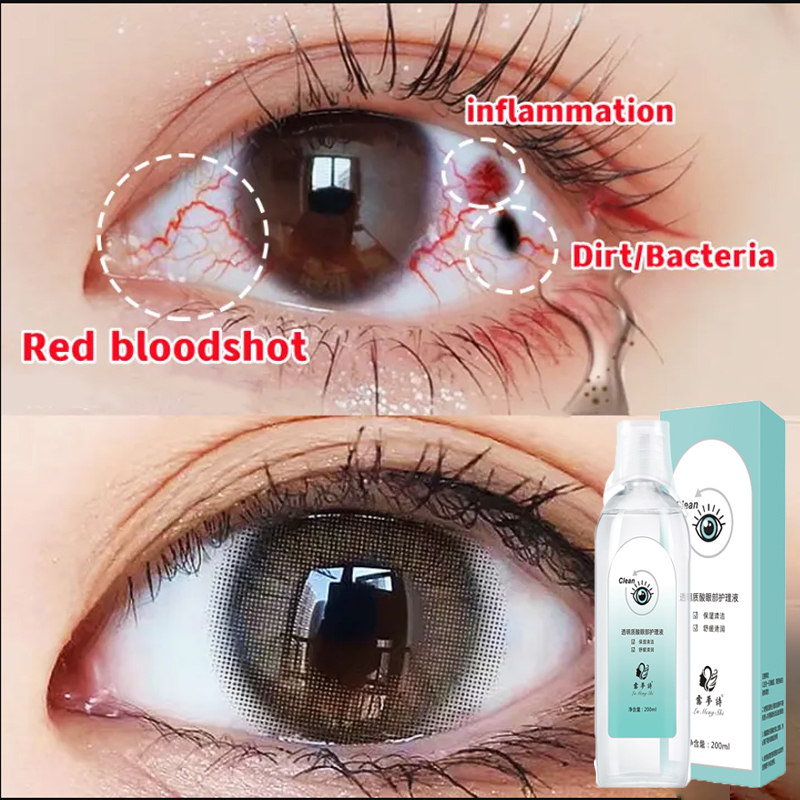 Obat tetes mata Tetes Mata Herbal Tetes Mata Alami eye drop 20ml Mata kering Sakit mata Darah Merah Ketegangan mata Mata gatal Minus Gatal Merah Belekan dan Berair, Glukoma Glaukoma Akut Katarak, Penglihatan Buram Obat Mata Berlemak Ada Selaput di Bagian