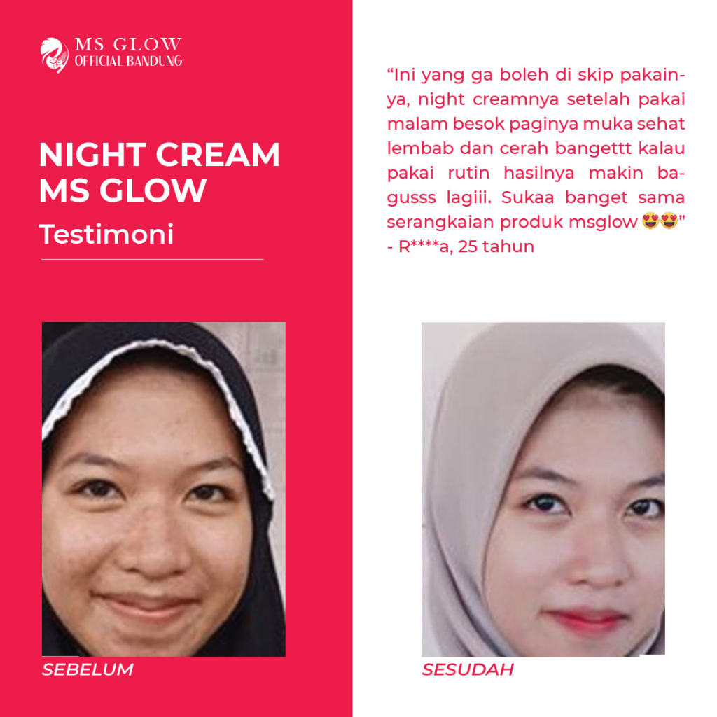 MS Glow Night Cream Whitening Cell DNA Acne Luminous Ultimate Original