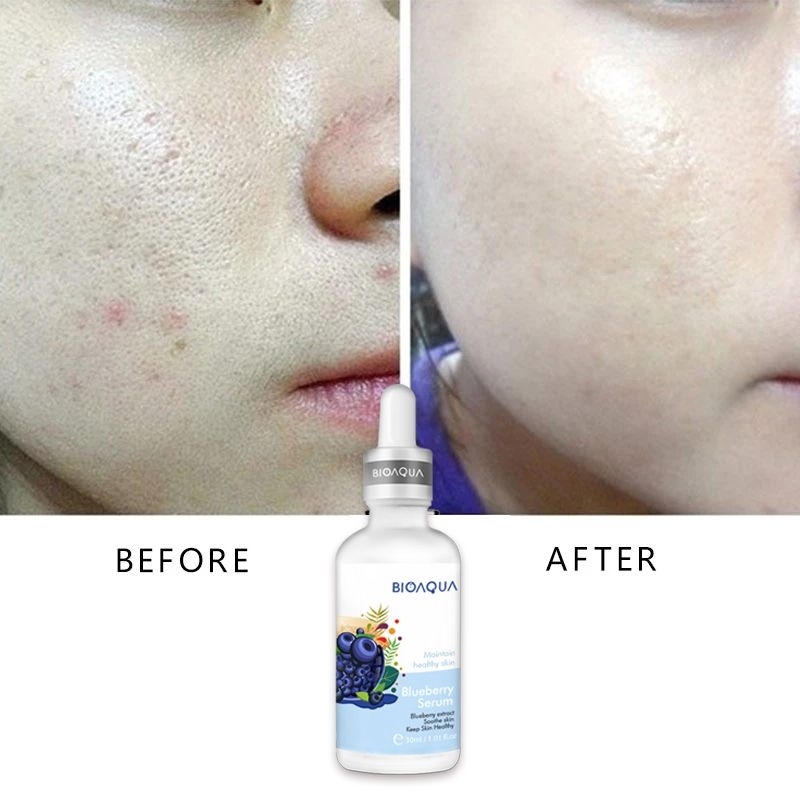 Bioaqua Serum Blueberry Extract BPOM Mencerahkan Melembabkan Menutrisi Mengecilkan Pori-Pori Menghilangkan Kerutan &amp; Flek Hitam / Bioaqua Blueberry Extract Serum Wajah Glowing / Blueberry Serum Wajah Bioaqua / Serum Pelembab Wajah / Serum Pencerah Wajah