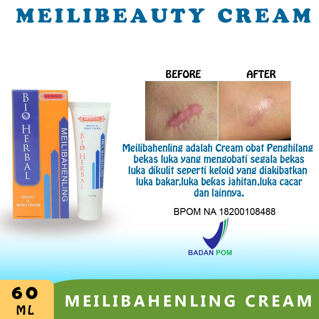 Salep Penghilang Bekas Luka Hitam Jerawat Koreng dan Keloid Cream Krim Penghilang Bekas Luka