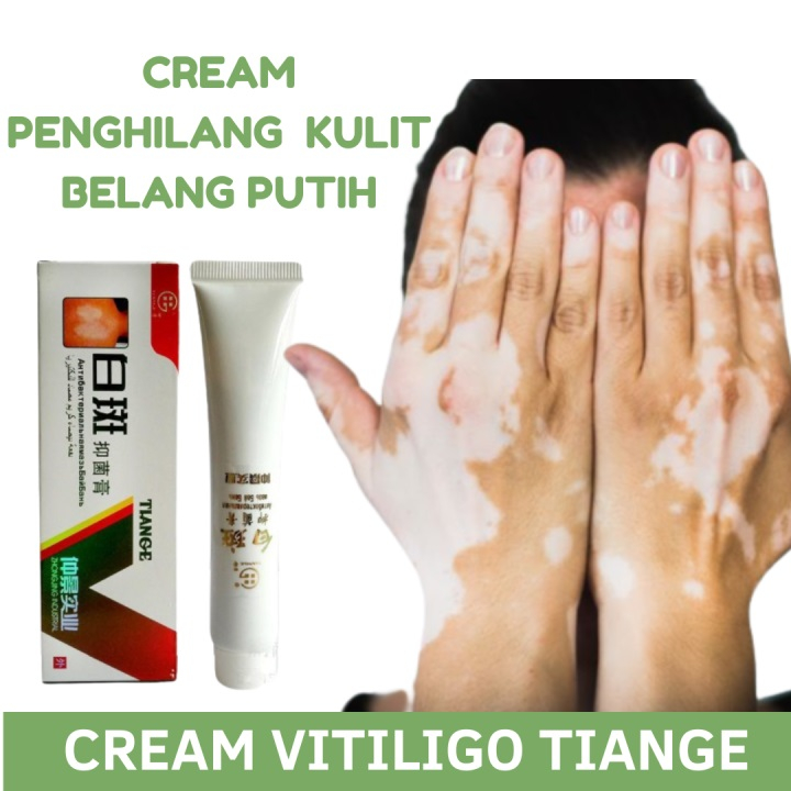 Salep Vitiligo Salep Tiange Penghilang Bercak Putih Bintik Putih