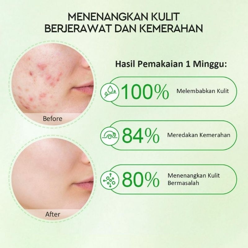 GLAD2GLOW - G2G Centella Allantoin Soothing Moisturizer Gel Repair Skin Barrier 30 g