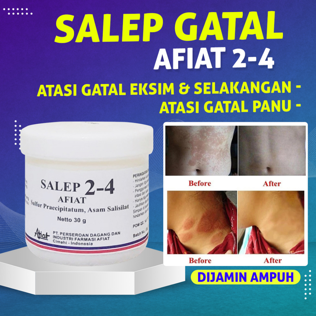 SALEP Afiat 24 Sulfur / Obat Salep Gatal Belerang / Obat Gatal Kulit Selangkangan Jamur Eksim Original