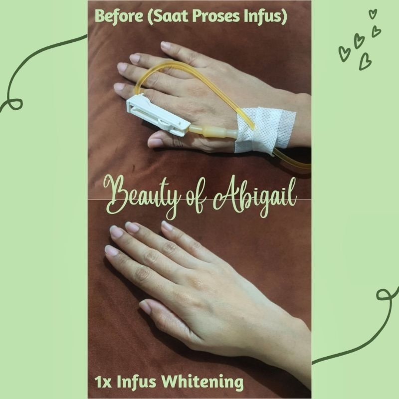 Infus Whitening / Infus Chromosome / Infus Chromosome Stemcell / Infus Kromosom