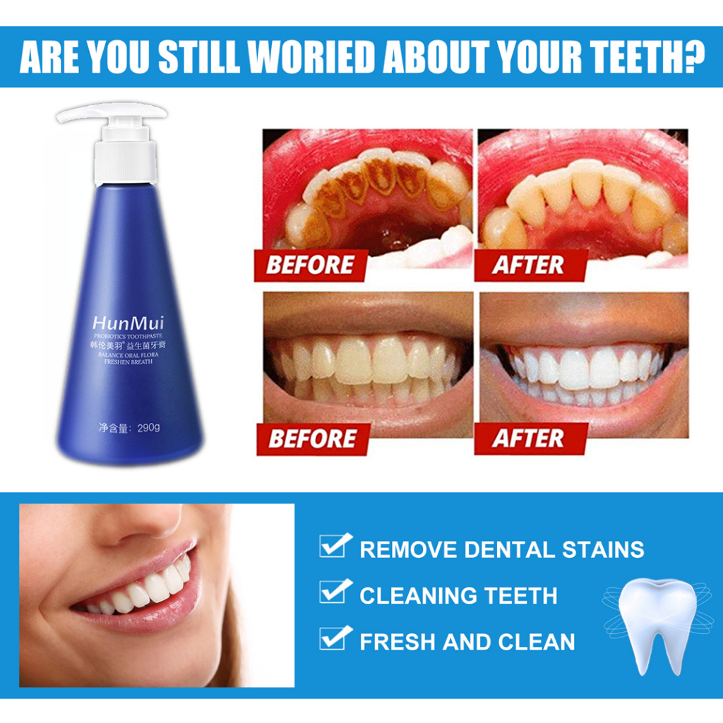 Pasta Gigi Pemutih Permanen Penghilang Karang Gigi dan Gigi Kuning 290g Press-Type Berkapasitas Besar Pasta Gigi Probiotik Menyeimbangkan Bakteri Mulut Teeth Whitening Toothpaste