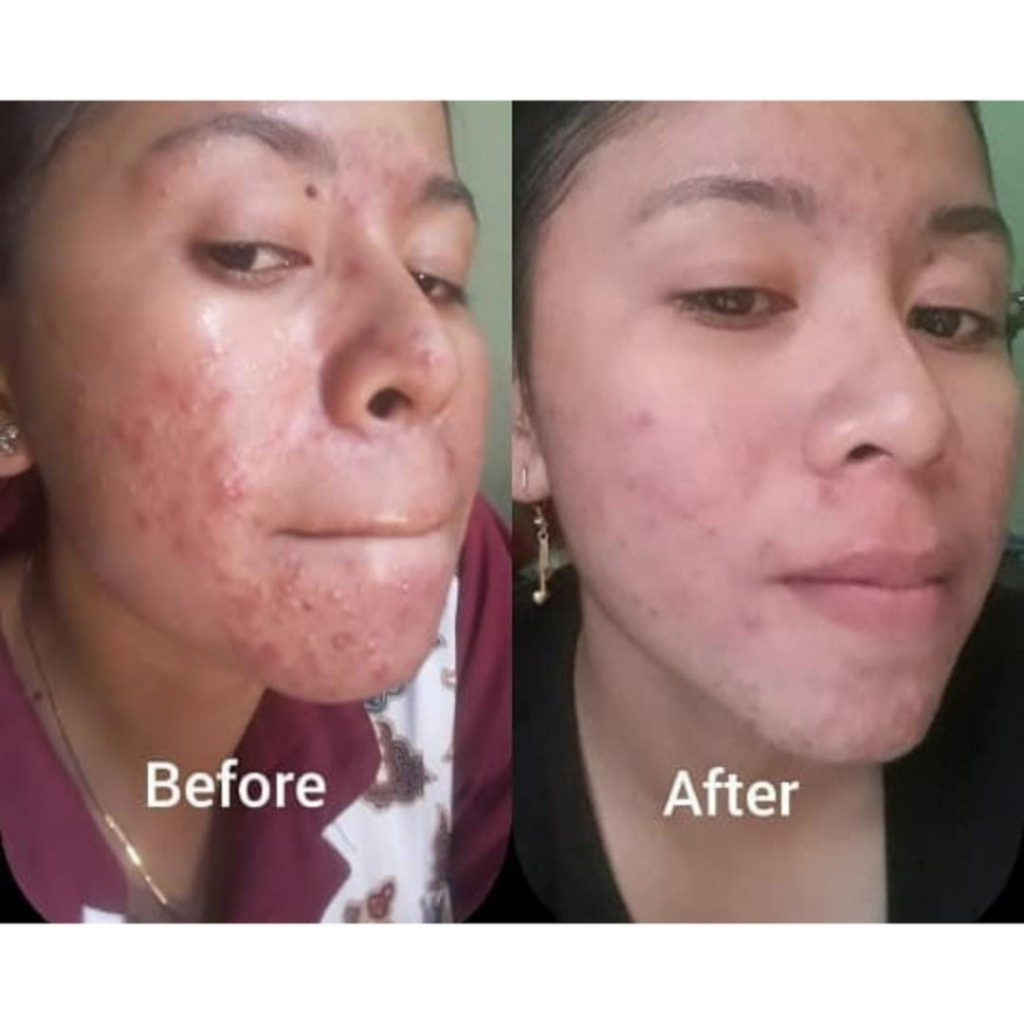 Sabun Batang Batangan Pencerah Pemutih Penghalus Kulit Wajah Muka Tubuh Badan Alami QM Brightening Soap Penghilang Bekas Luka Pengecil Poripori Pria Wanita Ori Cepat Permanen BPOM