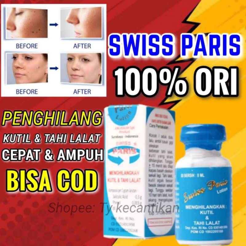 SWISS PARIS PENGHILANG TAHI LALAT ORIGINAL / PENGHILANG TAHI LALAT PERMANEN / PENGHILANG TAI LALAT /