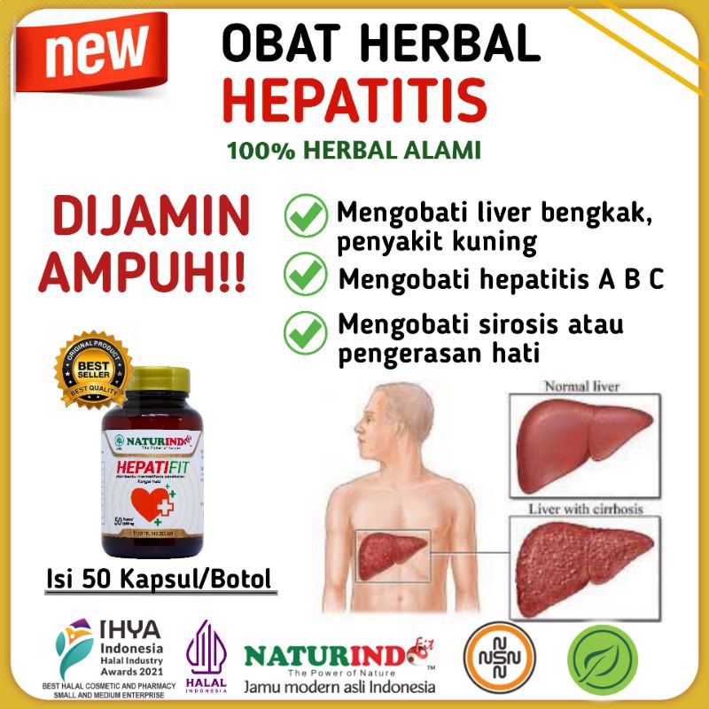 Obat Herbal Hepatitis a b c Ampuh Kuning Fatty Liver Bengkak Sirosis Pemabuk Berat Herbal Batu Emped