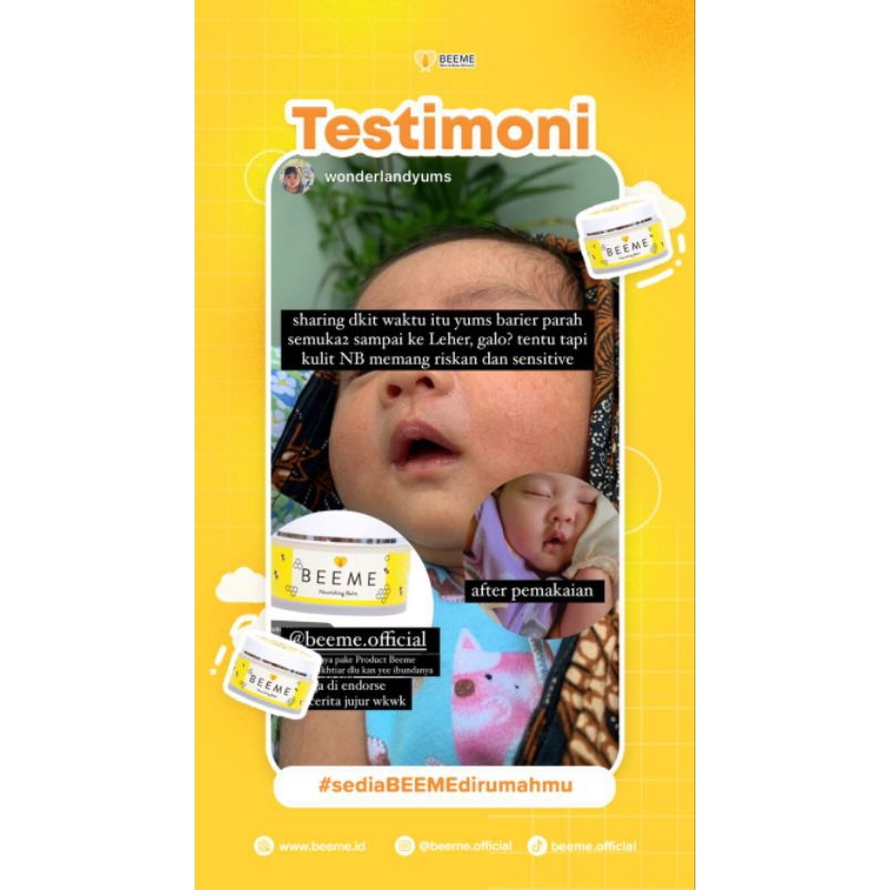 BEEME NOURISING BALM ORIGINAL || PELEMBAB SERBAGUNA