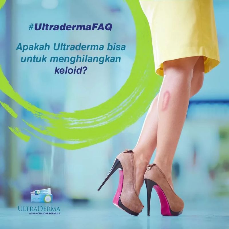 [ Ultra Derma ] Cream Penghilang Bekas Luka Operasi Iris Tergores Digigit Serangga