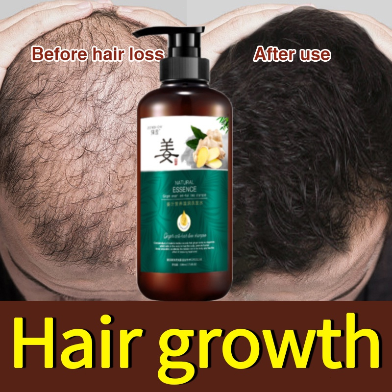 ZENSHOW Shampo Rambut Rontok dan Penumbuh Rambut Tebal 500ml Shampo Anti Ketombe Gatal Anti Rambut Rontok Formula Botani Fast Grow Shampoo 100% Original