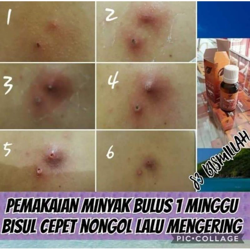 Minyak Bulus SR12/Pengencang Payud*ra/Pembesar Mr.P