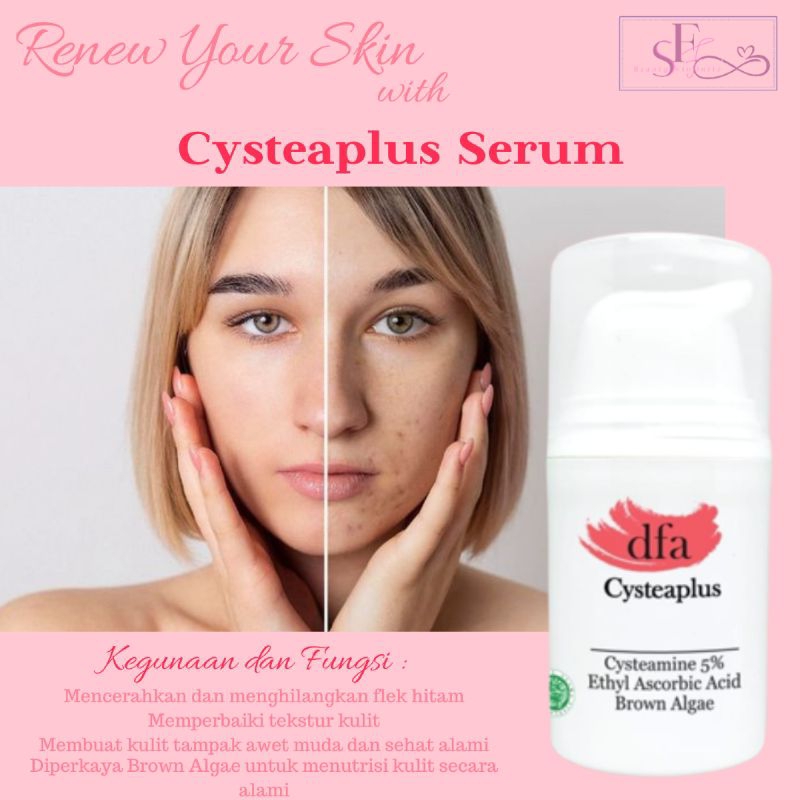 Cysteaplus DFA serum untuk menghilangkan flek hitam dan bekas jerawat