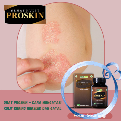 

OBAT HERBAL PROSKIN - cara mengatasi kulit kering bersisik dan gatal di badan, kaki, selangkangan, tangan, kelamin, kemaluan, paha, bokong, leher, wajah, jari, punggung, ketiak, perut, bibir, dada, lengan, siku, lutut, Lainnya