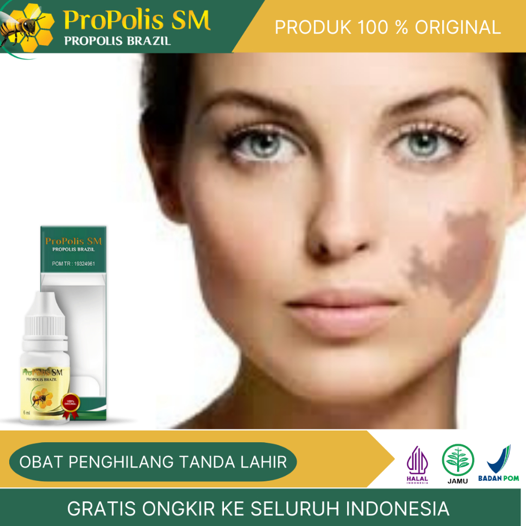 Obat Tetes Penghilang Tanda Lahir, Tanda Lahir Hitam, Coklat, Merah, Salep Pemudar Tanda Lahir Hitam