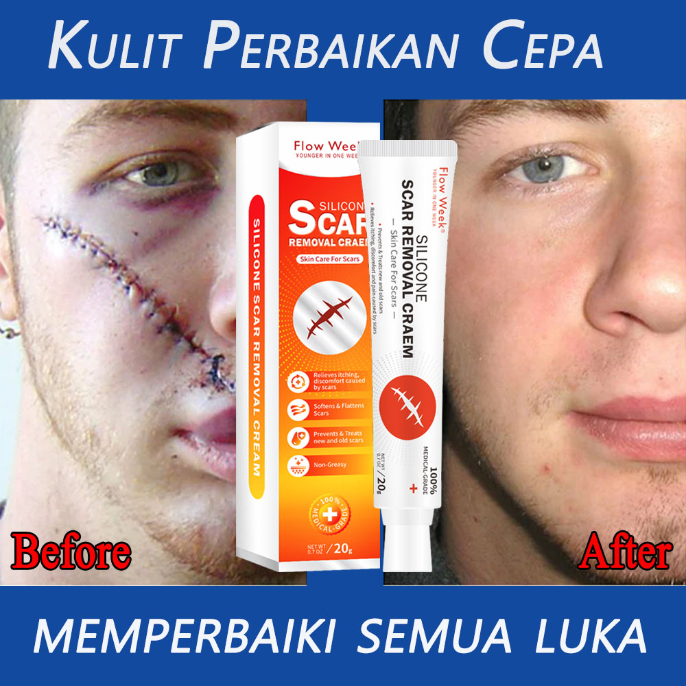 Flow Week Krim Penghilang Bekas Luka Keloid Perawatan Tempat Jerawat Stretch Mark Operasi Luka Bakar