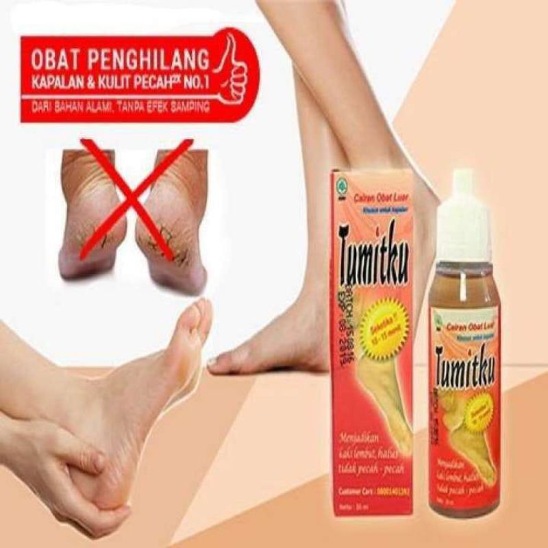 Tumitku / Tumit / obat kaki pecah