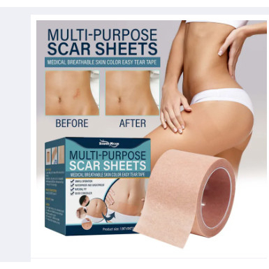 Scar Sheets Silikon Penghilang Bekas Luka Ampuh Silicone Scar Sheet