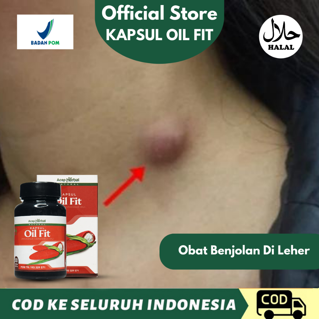Obat Benjolan Di Leher, Lipoma, Benjolan Dipayudara, Benjolan Di Miss V, Benjolan Kista, Mioma Uteri