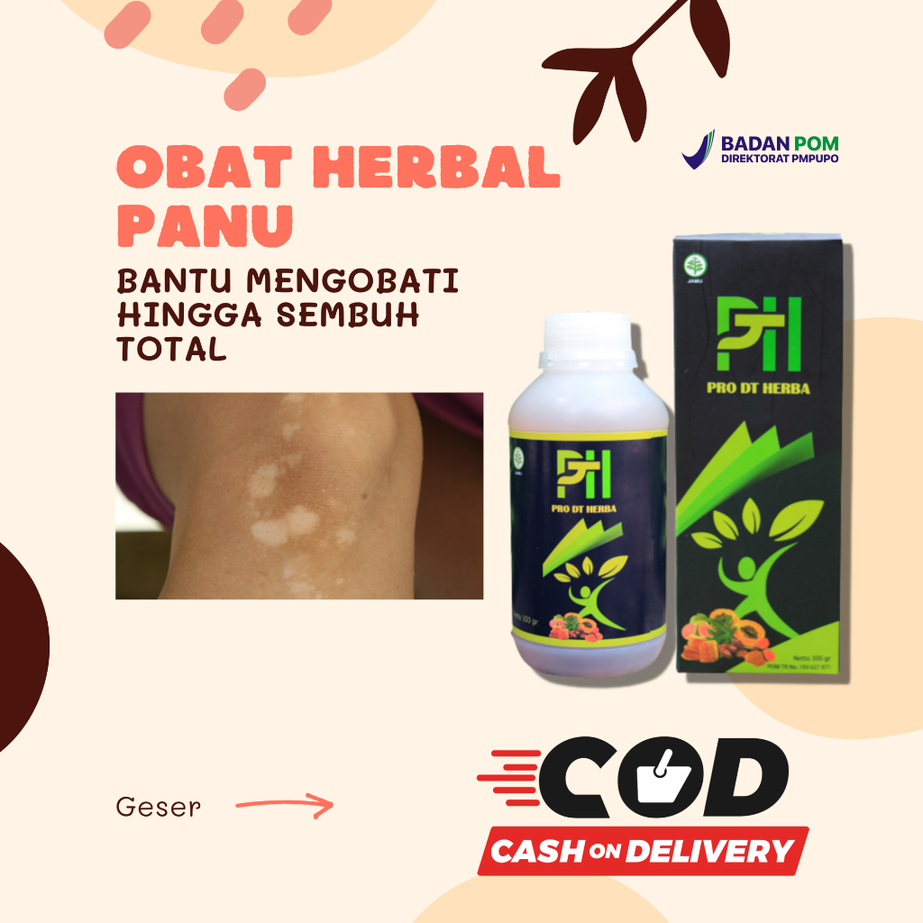 Obat Panu Paling Ampuh 100% dan Paling Cepat, Obat Panu Anak, Obat Panu Di Wajah, Obat Panu Ampuh Pe